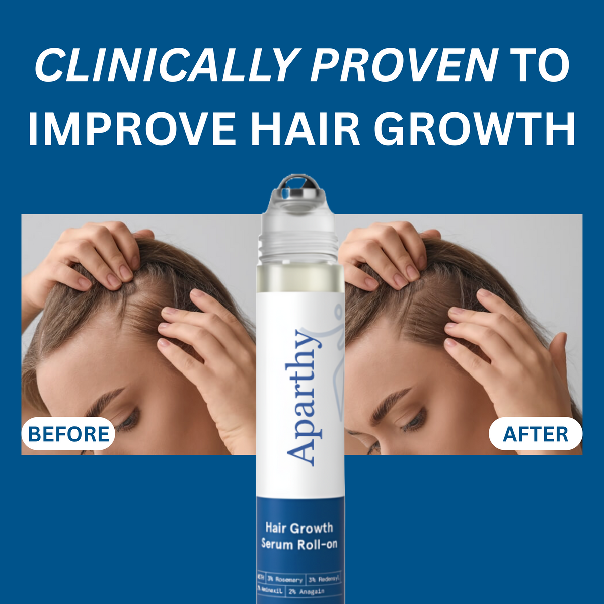 Zestlim Hair Growth Roll on Serum