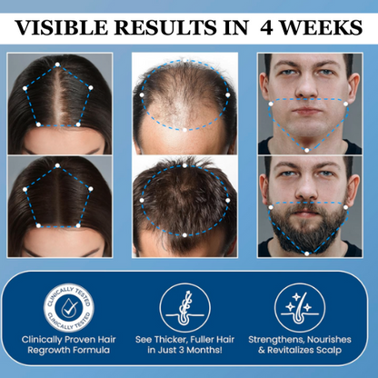 Zestlim Hair Growth Roll on Serum