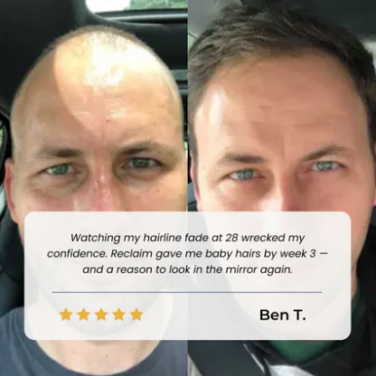 Zestlim Hair Growth Roll on Serum